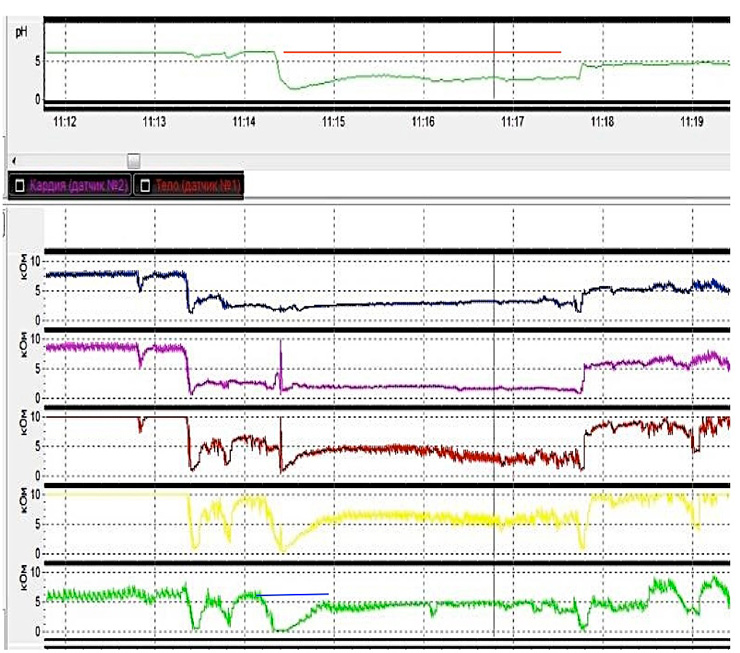Fig. III. Chemical (red line) and volume (blue line) clearance time in ERD (left picture) and NERD (right picture) patients